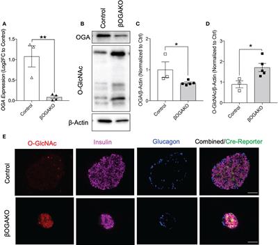 Pancreatic β-cell hyper-O-GlcNAcylation leads to impaired glucose homeostasis in vivo